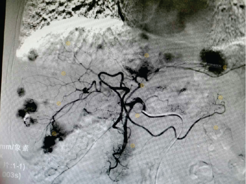 1-070836920.png 1661e5656026c7501d3132013a9371dc.png