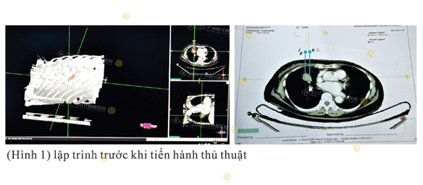 1-071706851.png image.png