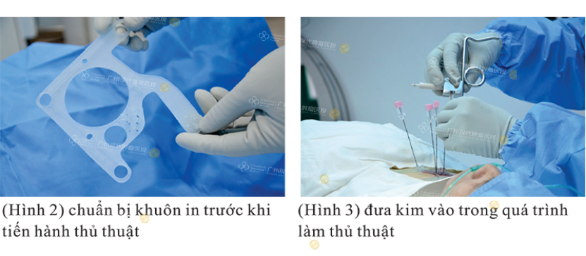 1-071725275.png image.png