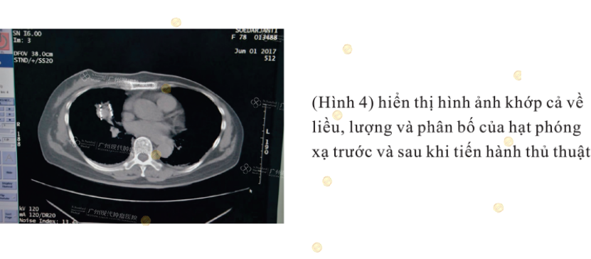 1-071745321.png image.png