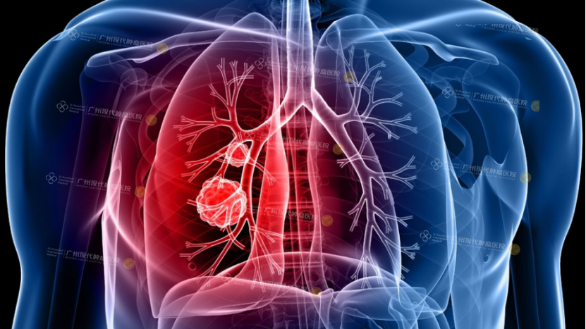 1-082500321.png image.png