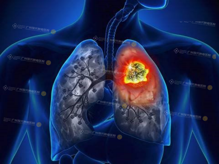 1-082511102.png image.png