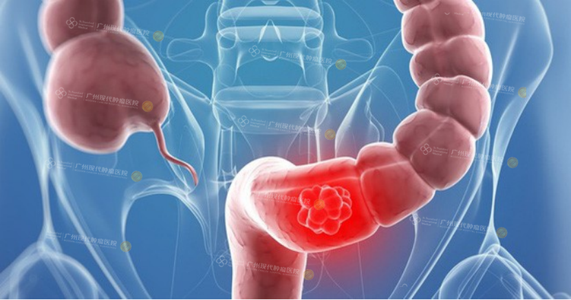 1-082901425.png image.png