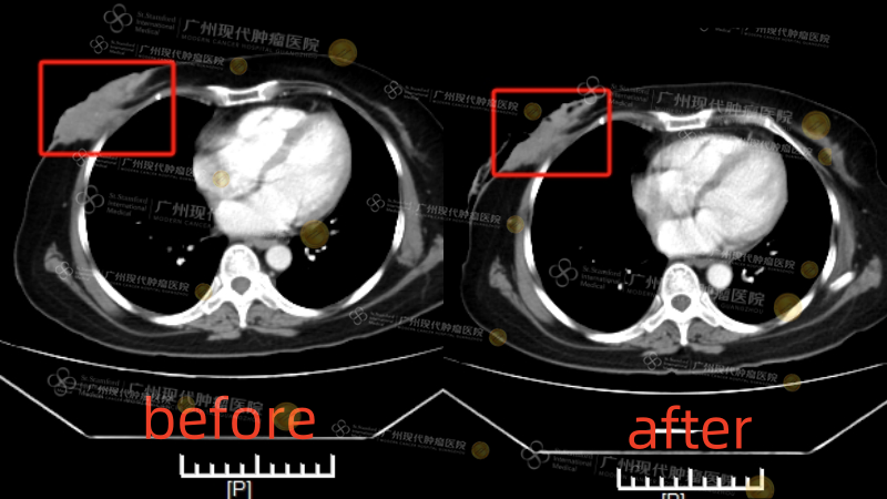 1-06111441.png 图片9.png
